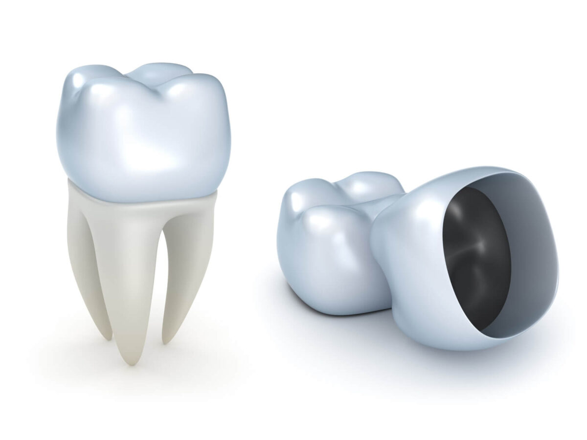 Dental Crowns: Your Solution To Stronger And Healthier Teeth